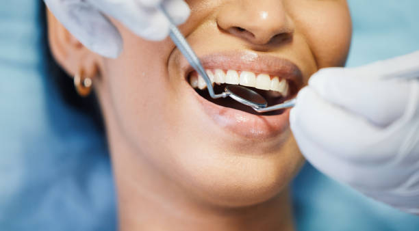Best Emergency Dentist for Knocked-Out Tooth in Susan Moore, AL