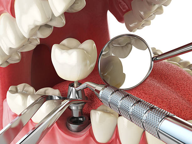  Susan Moore, AL Emergency Dentist Pros